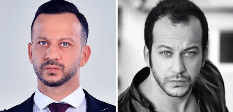  Saç ektiren ünlü isimler 