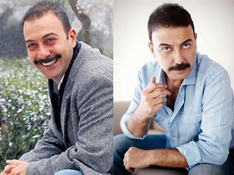  Saç ektiren ünlü isimler 