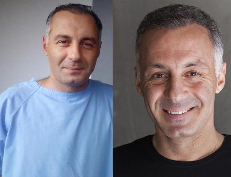  Saç ektiren ünlü isimler 