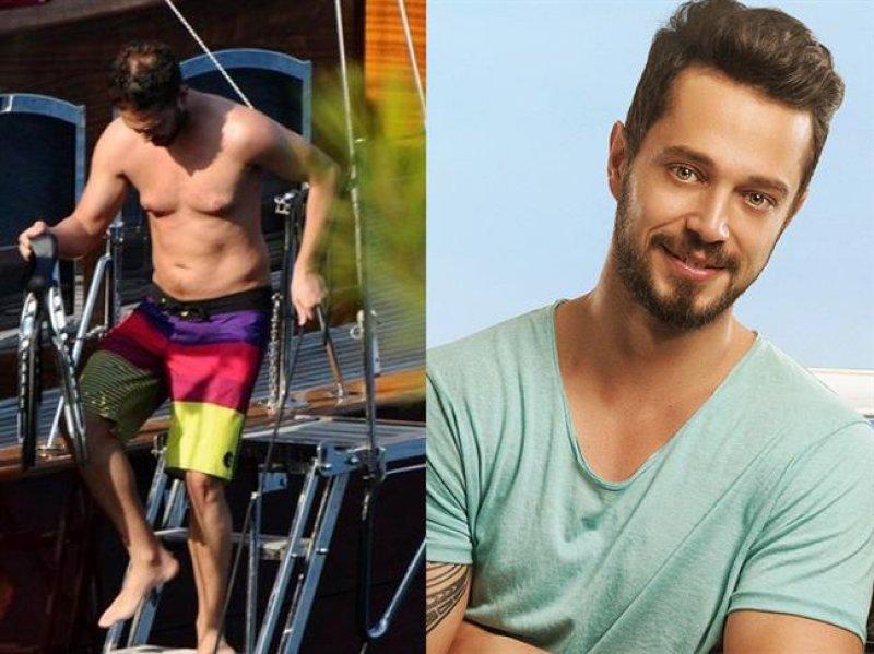  Saç ektiren ünlü isimler 