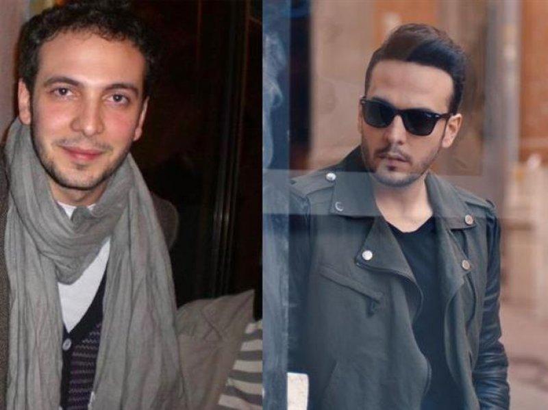  Saç ektiren ünlü isimler 