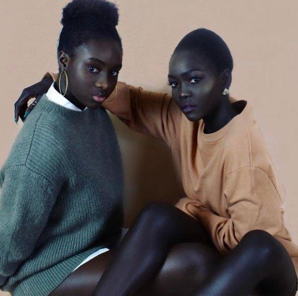 Instagram'ın sıradışı fenomeni Nyakim Gatwech