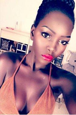 Instagram'ın sıradışı fenomeni Nyakim Gatwech