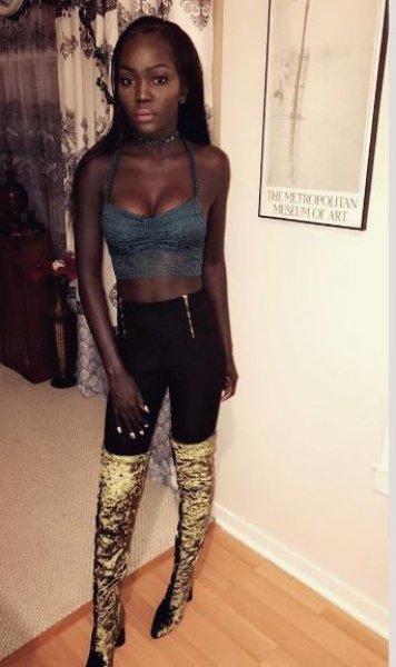 Instagram'ın sıradışı fenomeni Nyakim Gatwech