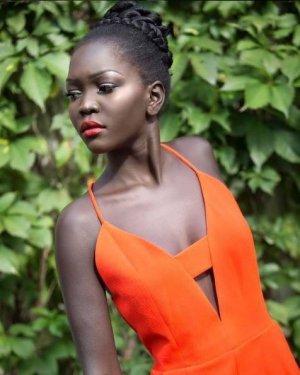 Instagram'ın sıradışı fenomeni Nyakim Gatwech