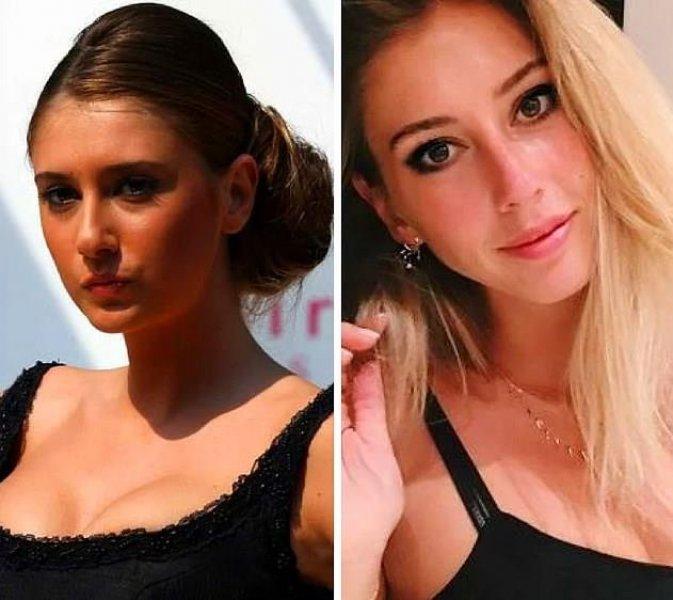 Küçük yaşta estetik yaptıran ünlü isimler 