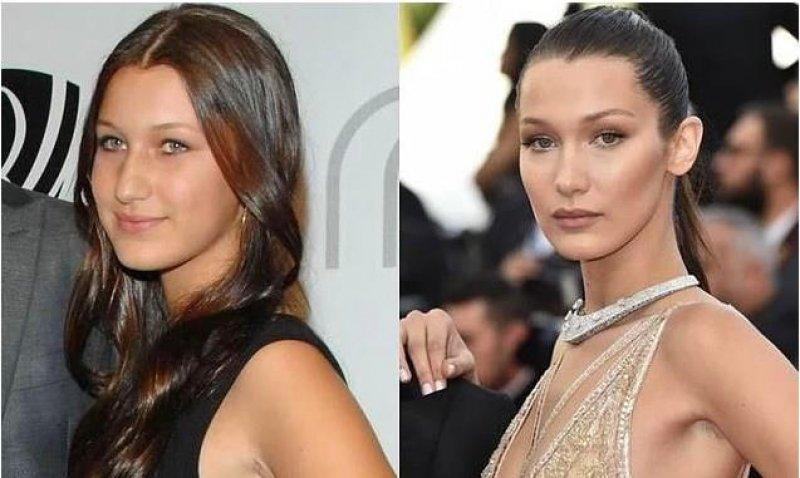 Küçük yaşta estetik yaptıran ünlü isimler 