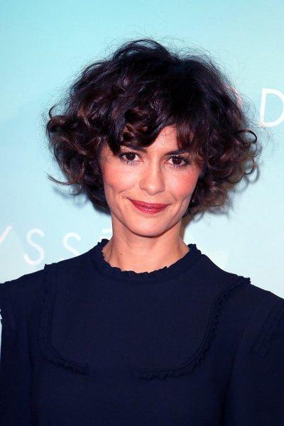 Yeni trend gamze estetiği 