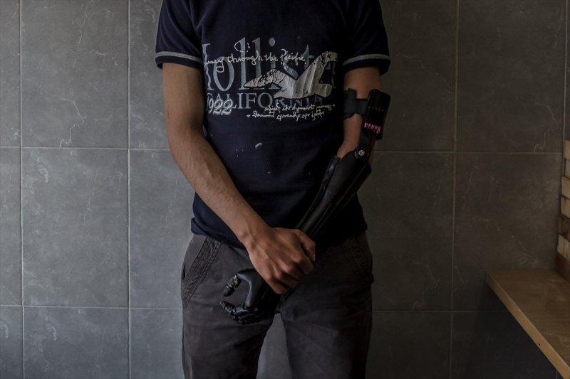 Engelliler için 3D yazıcılar ile 'kendin yap' projesi