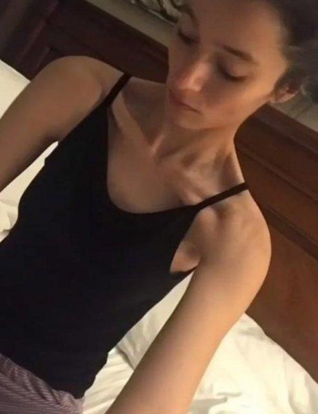 Şarkıcı Ayşe Akın geçirdiği anoreksiya hastalığını anlattı