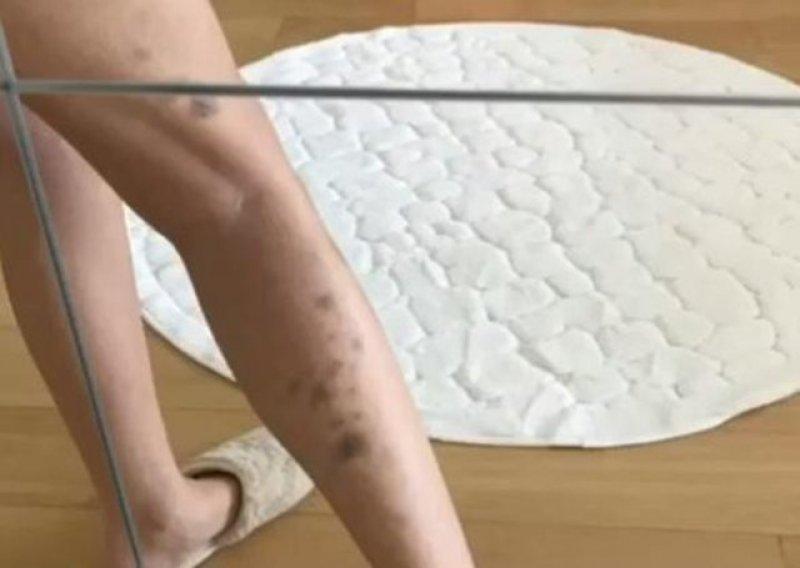 Şarkıcı Ayşe Akın geçirdiği anoreksiya hastalığını anlattı