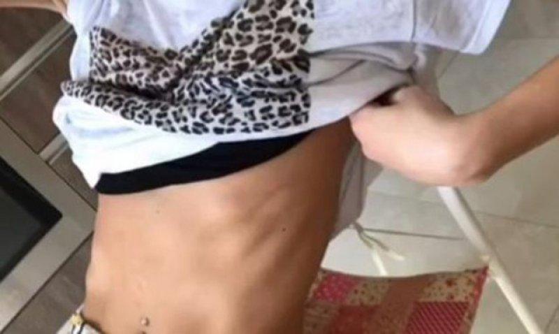 Şarkıcı Ayşe Akın geçirdiği anoreksiya hastalığını anlattı