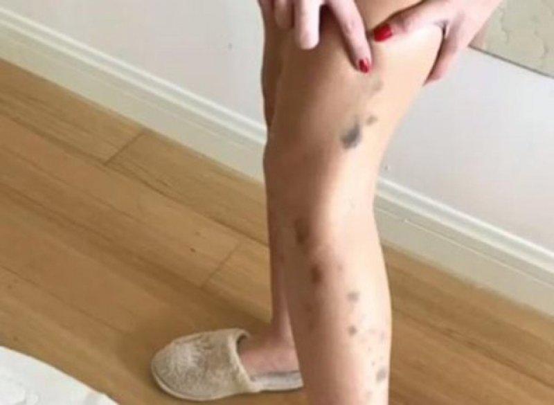 Şarkıcı Ayşe Akın geçirdiği anoreksiya hastalığını anlattı