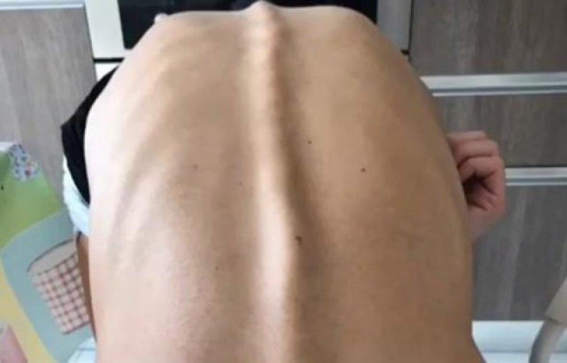 Şarkıcı Ayşe Akın geçirdiği anoreksiya hastalığını anlattı