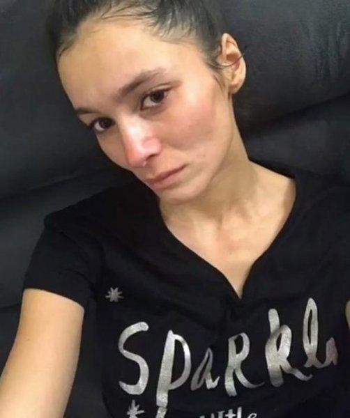 Şarkıcı Ayşe Akın geçirdiği anoreksiya hastalığını anlattı