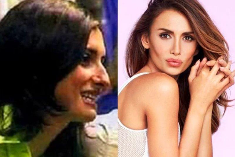 Estetik operasyon ile değişen ünlüler 