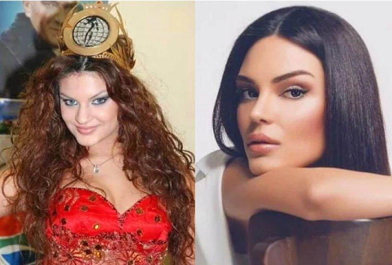 Estetik operasyon ile değişen ünlüler 