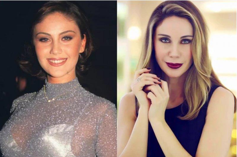 Estetik operasyon ile değişen ünlüler 