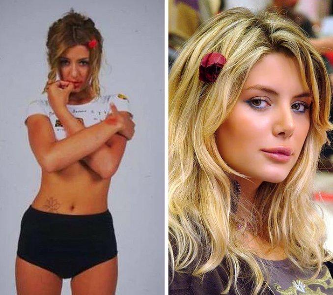 Estetik operasyon ile değişen ünlüler 