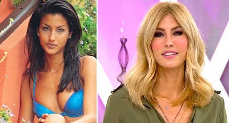 Estetik operasyon ile değişen ünlüler 