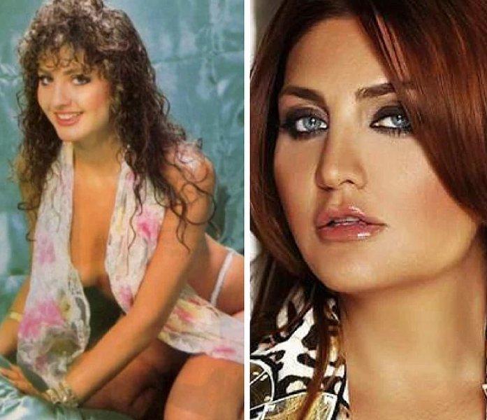 Estetik operasyon ile değişen ünlüler 