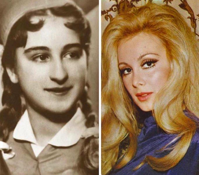 Estetik operasyon ile değişen ünlüler 