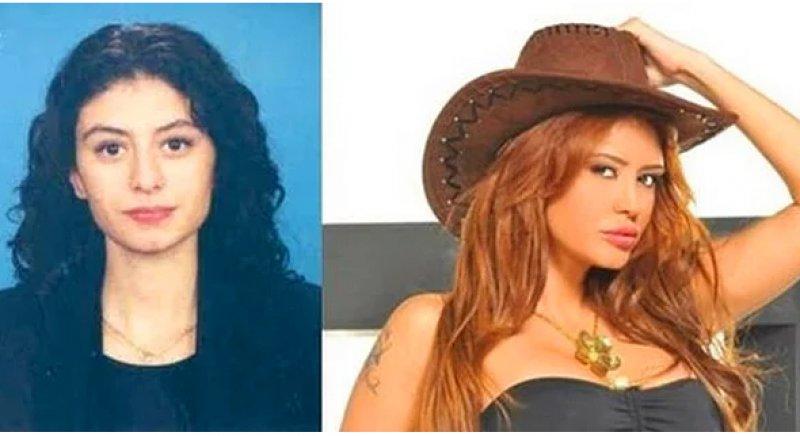 Estetik operasyon ile değişen ünlüler 