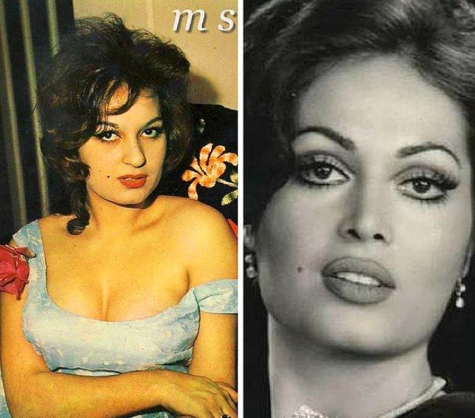 Estetik operasyon ile değişen ünlüler 