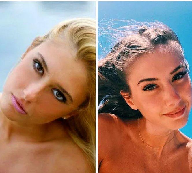 Estetik operasyon ile değişen ünlüler 