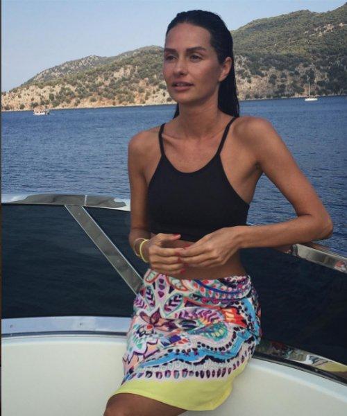 Yasemin Özilhan da estetik yaptıran ünlülerden 