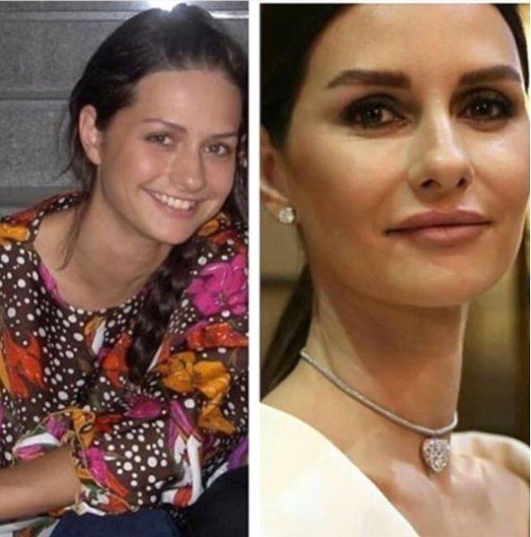 Yasemin Özilhan da estetik yaptıran ünlülerden 