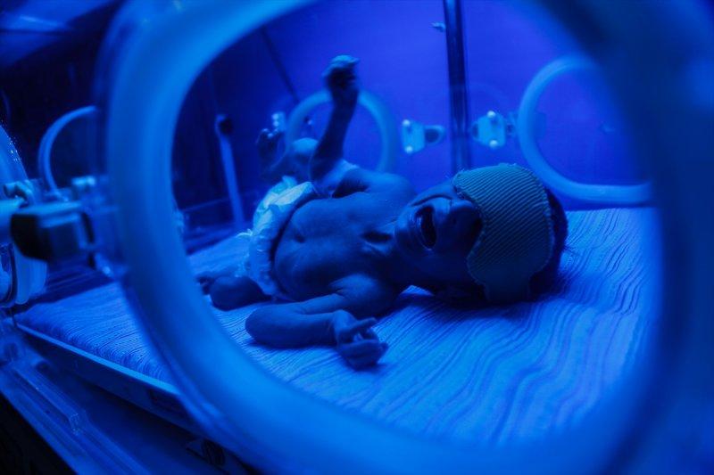 Doğu Guta'daki insani durum kritik noktada