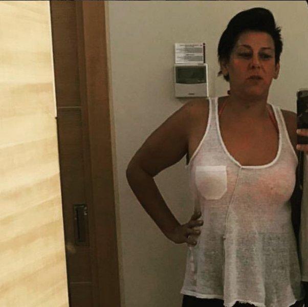 Oyuncu Esin Gündoğdu 2 yılda 60 kilo verdi