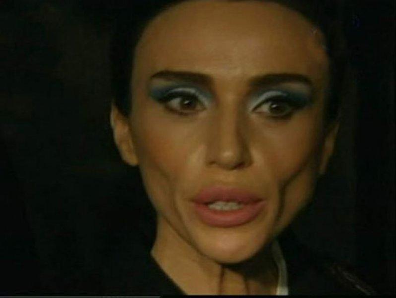 Diyeti abartıp gereğinden fazla zayıflayan ünlüler