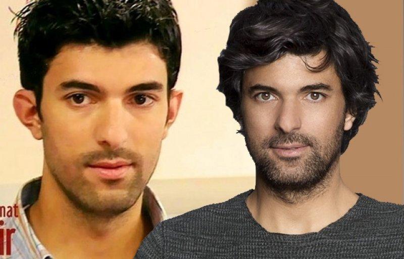 Oyuncu Engin Akyürek estetik yaptırdı iddiası 