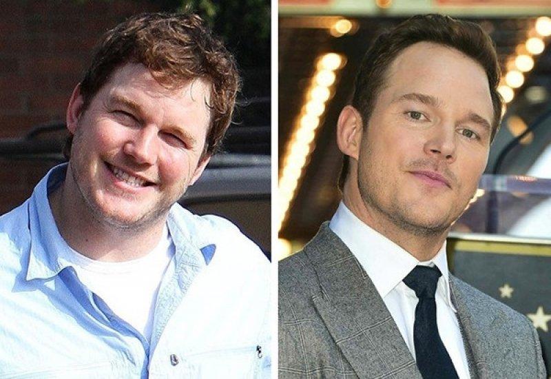 Ünlülerin bilinmeyen trajik yaşam hikayeleri 