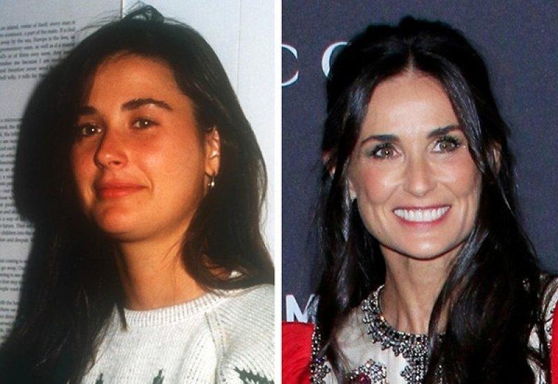 Ünlülerin bilinmeyen trajik yaşam hikayeleri 