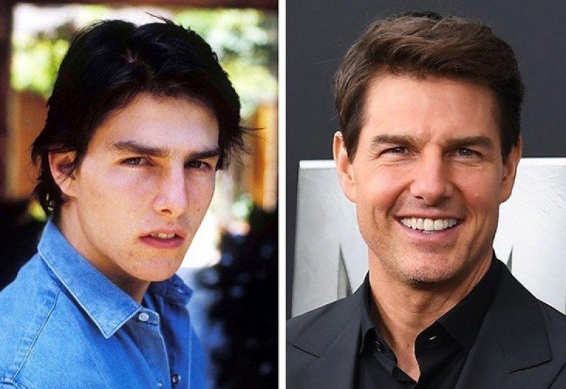 Ünlülerin bilinmeyen trajik yaşam hikayeleri 