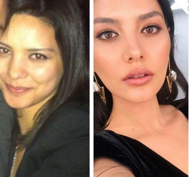 Oyuncuların inanılmaz değişimi 