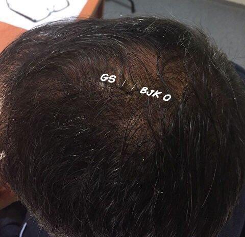 Galatasaray-Beşiktaş maçı capsleri (29.04.2018)