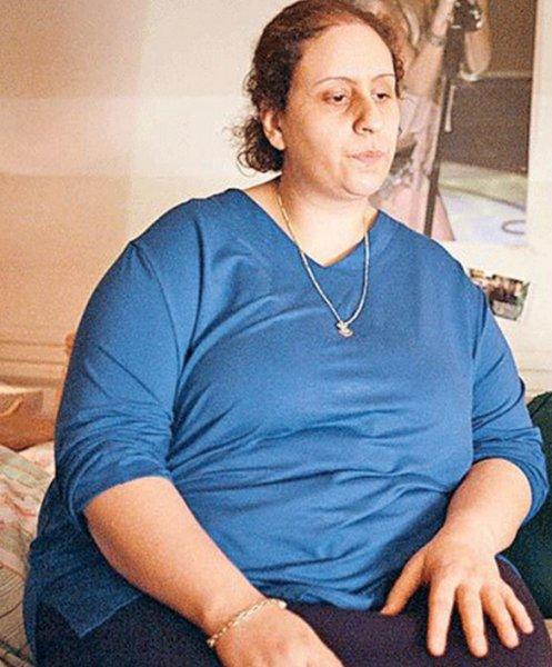 Zayıflayarak bambaşka biri olan ünlüler 