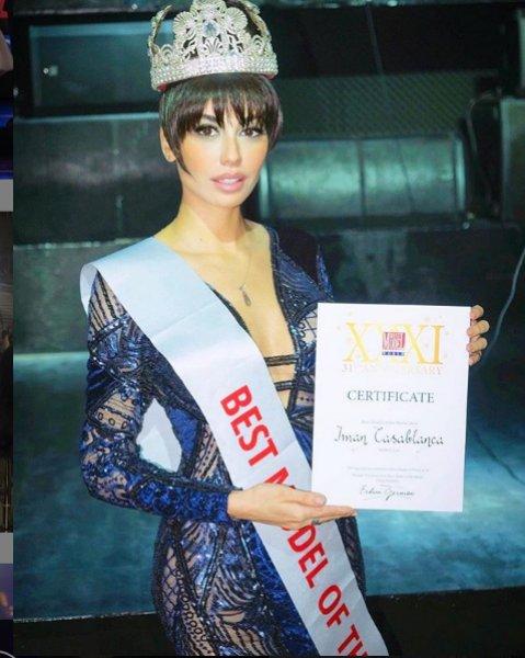 Best Model of the World birincisinin dikkat çeken güzelliği 