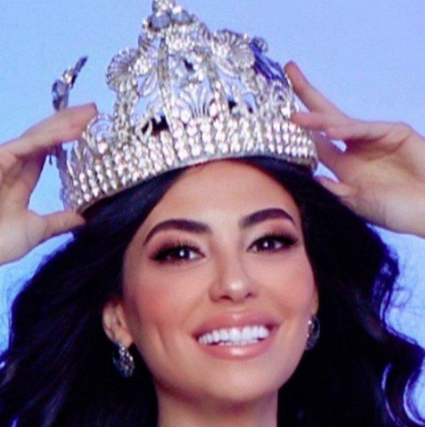 Best Model of the World birincisinin dikkat çeken güzelliği 