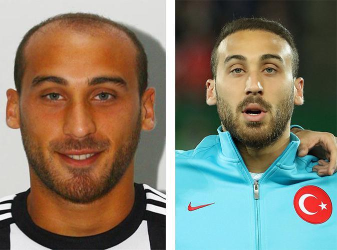 Futbolcuların estetiksiz halleri