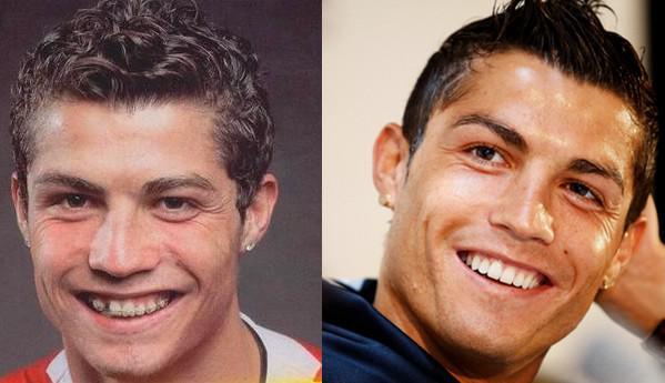 Futbolcuların estetiksiz halleri