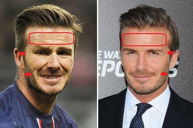 Futbolcuların estetiksiz halleri