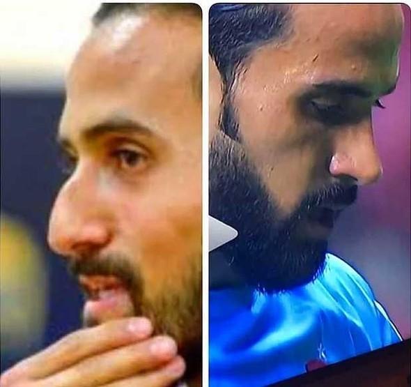 Futbolcuların estetiksiz halleri