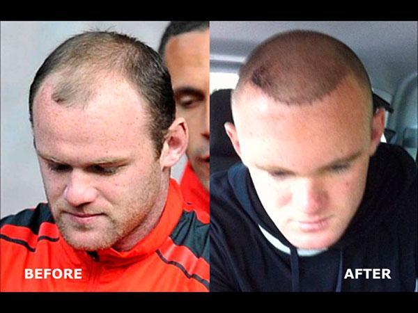 Futbolcuların estetiksiz halleri