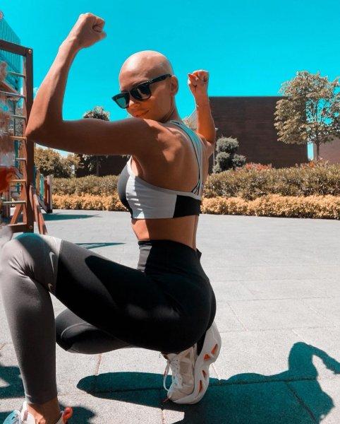 Meme kanseri ile mücadele eden şarkıcı Şimal'in sosyal medya paylaşımları