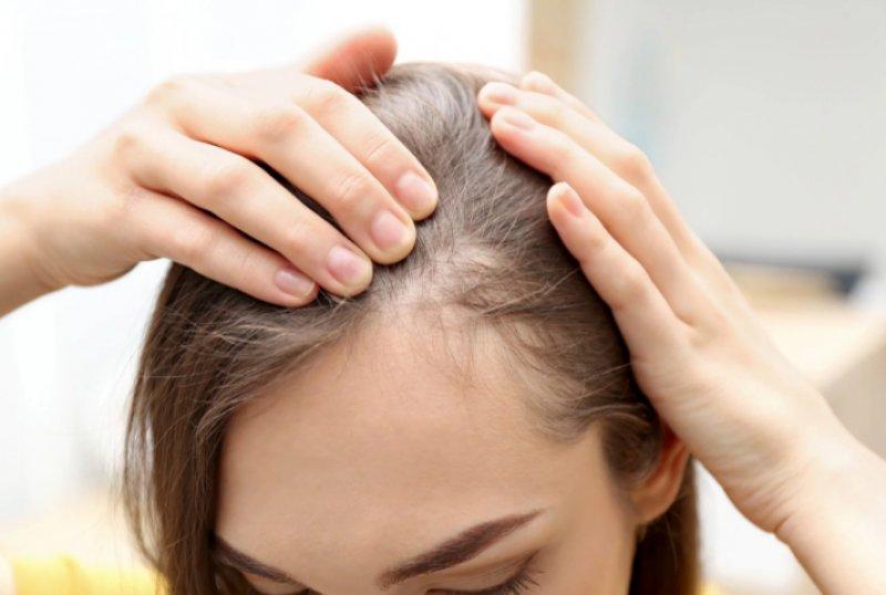 Erken yaşta saç beyazlatan nedenler ve alınacak önlemler